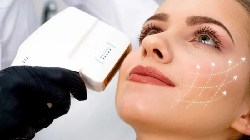 هایفوتراپی صورت چیست و چقدر ماندگاری دارد؟